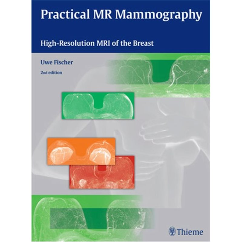 Practical MR Mammography - High-Resolution MRI of the Breast